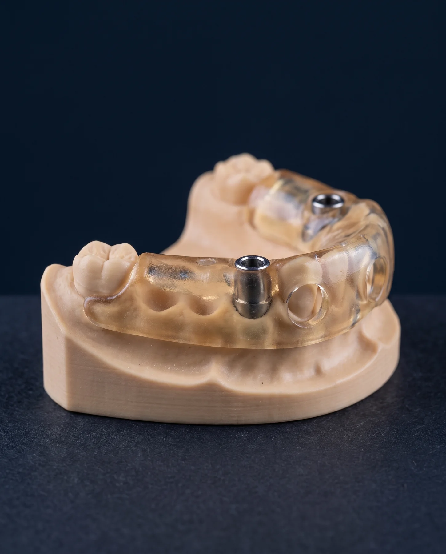 Szablony do implantacji nawigowanej